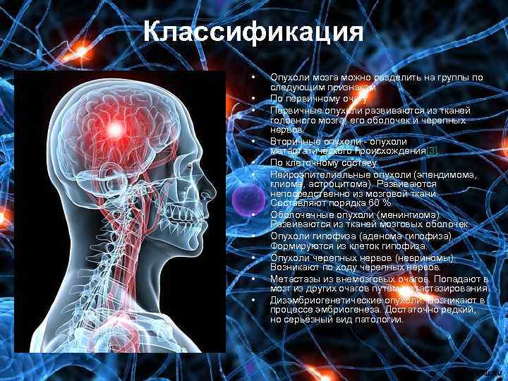 Причина рака головного. Опухоль головного мозга симптомы. Опухоли головного мозга классификация. Симптоматика опухолей головного мозга. Опухоли нервной системы и оболочек мозга.