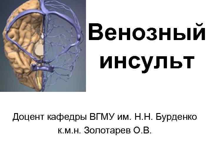 Венозный инсульт Доцент кафедры ВГМУ им. Н. Н. Бурденко к. м. н. Золотарев О.