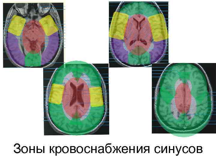 Зоны кровоснабжения синусов 