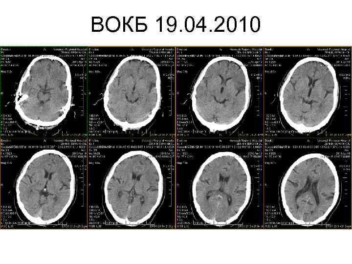 ВОКБ 19. 04. 2010 