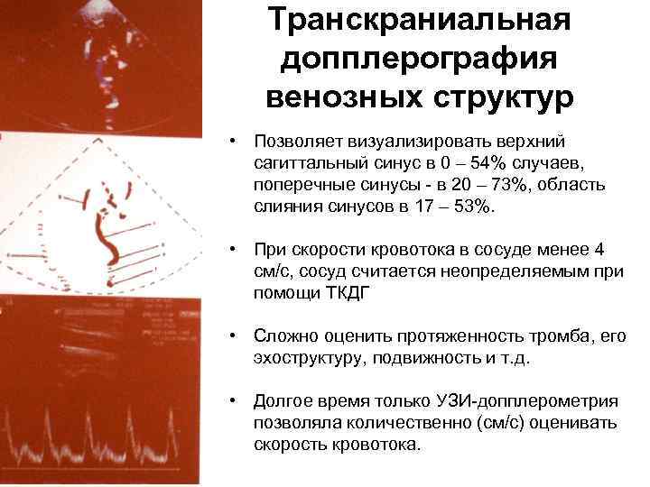 Транскраниальная допплерография венозных структур • Позволяет визуализировать верхний сагиттальный синус в 0 – 54%