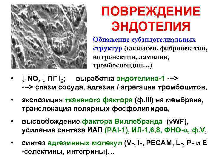 ПОВРЕЖДЕНИЕ ЭНДОТЕЛИЯ Обнажение субэндотелиальных структур (коллаген, фибронек-тин, витронектин, ламилин, тромбоспондин…) • ↓ NO, ↓