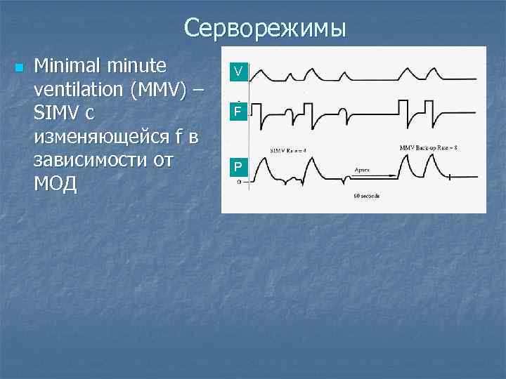 Серворежимы n Minimal minute ventilation (MMV) – SIMV с изменяющейся f в зависимости от