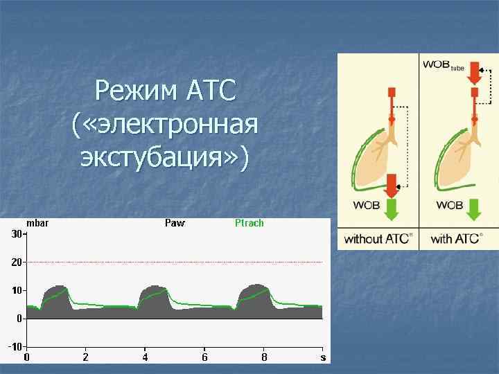 Режим ATC ( «электронная экстубация» ) 