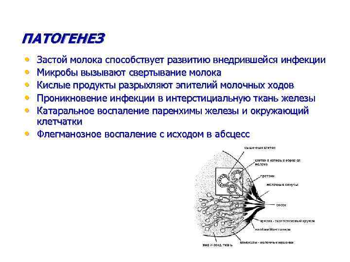 ПАТОГЕНЕЗ • • • Застой молока способствует развитию внедрившейся инфекции Микробы вызывают свертывание молока