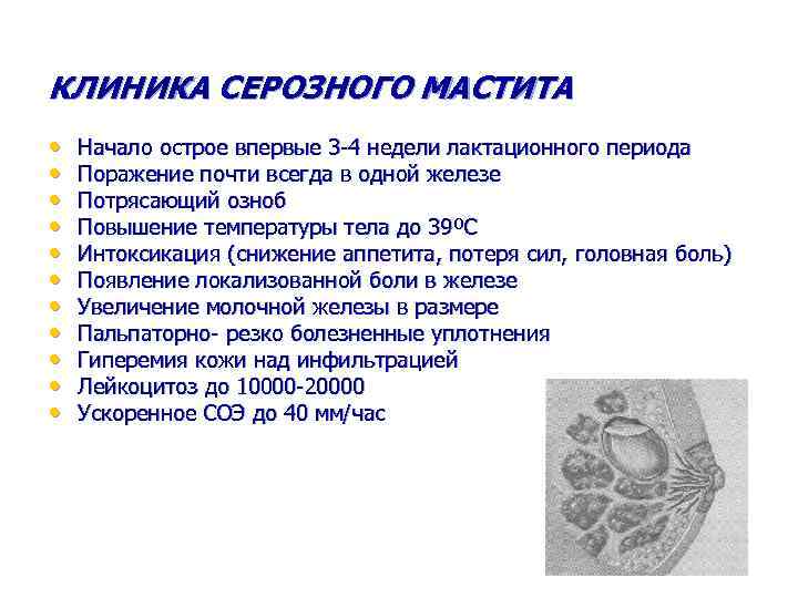 КЛИНИКА СЕРОЗНОГО МАСТИТА • • • Начало острое впервые 3 -4 недели лактационного периода