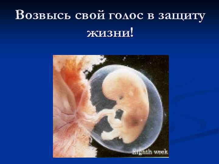 Возвысь свой голос в защиту жизни! 