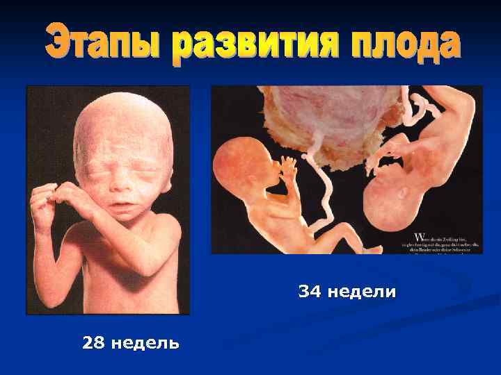34 недели 28 недель 