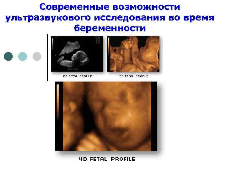 Современные возможности ультразвукового исследования во время беременности 