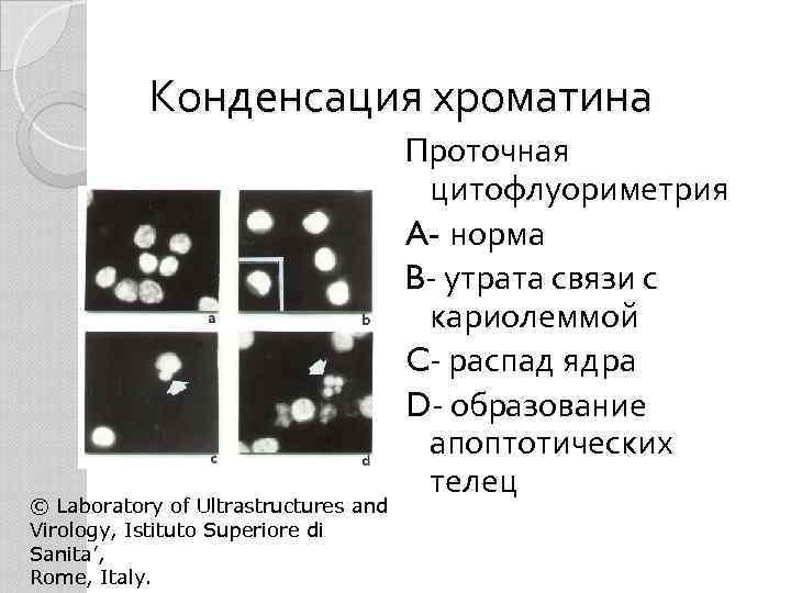 Конденсация хроматина © Laboratory of Ultrastructures and Virology, Istituto Superiore di Sanita’, Rome, Italy.