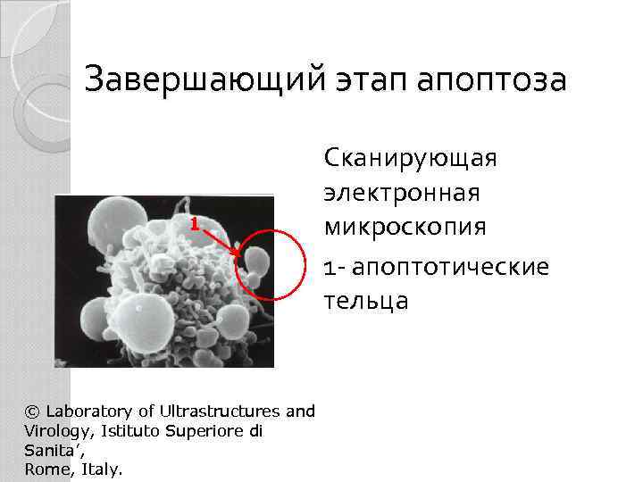 Завершающий этап апоптоза 1 © Laboratory of Ultrastructures and Virology, Istituto Superiore di Sanita’,