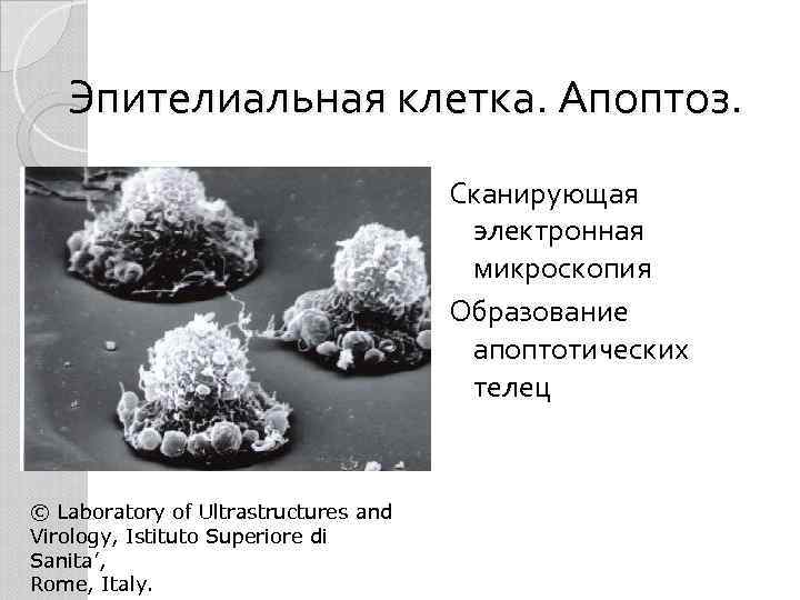 Эпителиальная клетка. Апоптоз. Сканирующая электронная микроскопия Образование апоптотических телец © Laboratory of Ultrastructures and