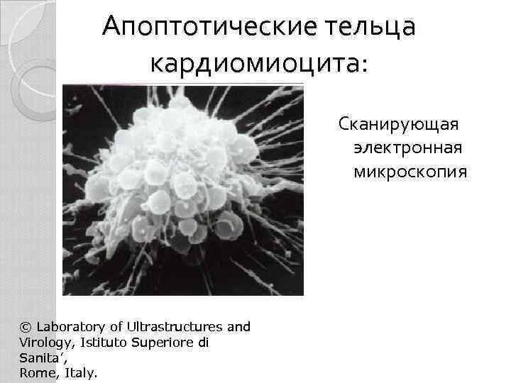 Апоптотические тельца кардиомиоцита: Сканирующая электронная микроскопия © Laboratory of Ultrastructures and Virology, Istituto Superiore