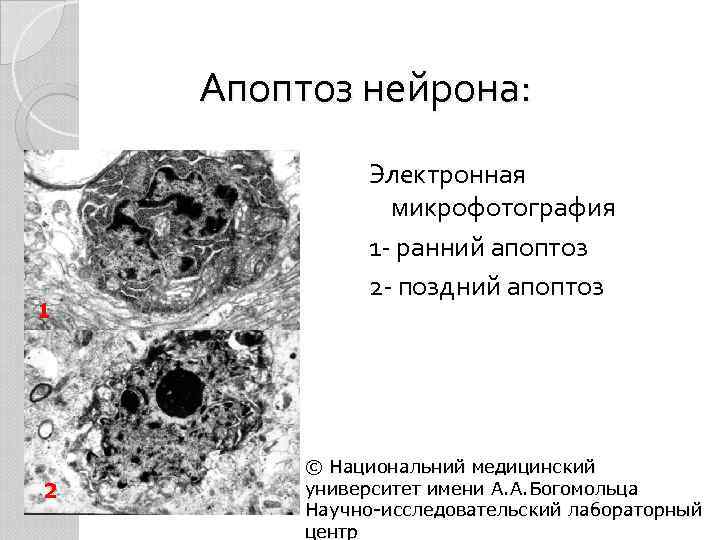 Апоптоз нейрона: 1 2 Электронная микрофотография 1 - ранний апоптоз 2 - поздний апоптоз