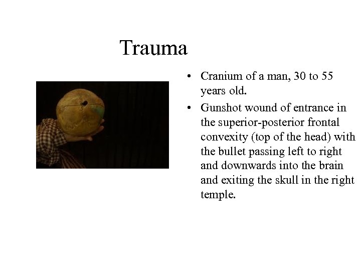 Trauma • Cranium of a man, 30 to 55 years old. • Gunshot wound
