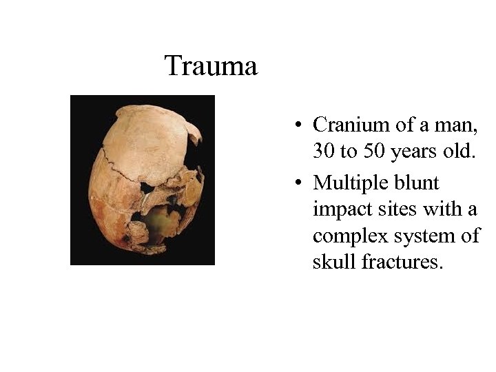 Trauma • Cranium of a man, 30 to 50 years old. • Multiple blunt