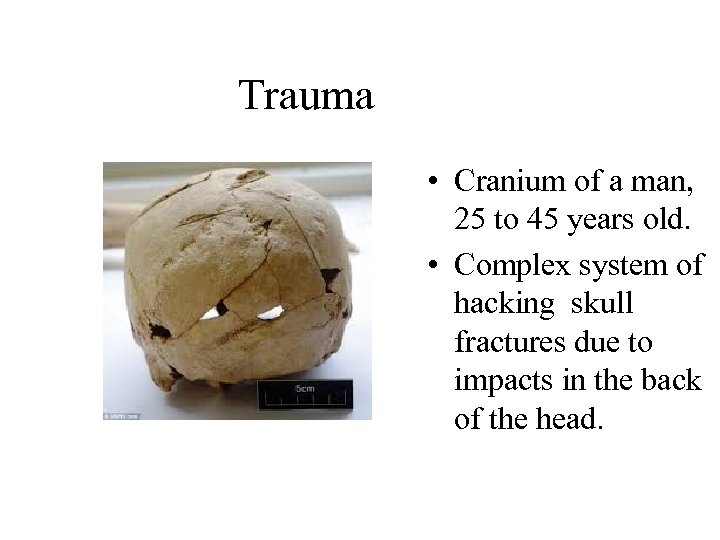 Trauma • Cranium of a man, 25 to 45 years old. • Complex system