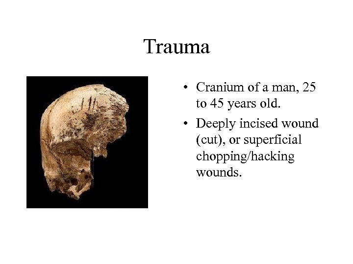 Trauma • Cranium of a man, 25 to 45 years old. • Deeply incised