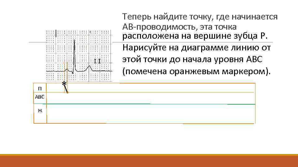 Теперь найдите точку, где начинается АВ-проводимость, эта точка расположена на вершине зубца P. Нарисуйте