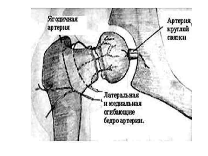 Рана бедренной артерии