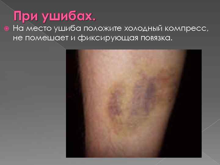 При ушибах. На место ушиба положите холодный компресс, не помешает и фиксирующая повязка. 