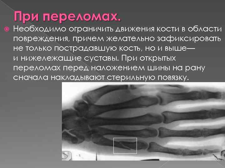 Нарушение целостности ткани. При открытом переломе со смещением необходимо. При открытом переломе со смещением кости необходимо. При открытом переломе при смещении кости необходимо. При закрытом переломе со смещением костей необходимо:.