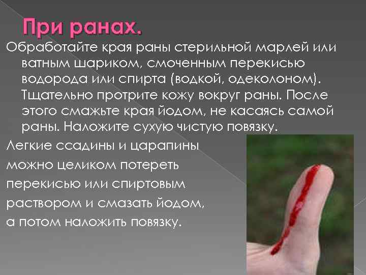 При ранах. Обработайте края раны стерильной марлей или ватным шариком, смоченным перекисью водорода или