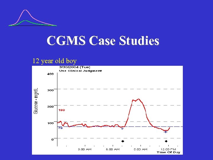 CGMS Case Studies 12 year old boy 