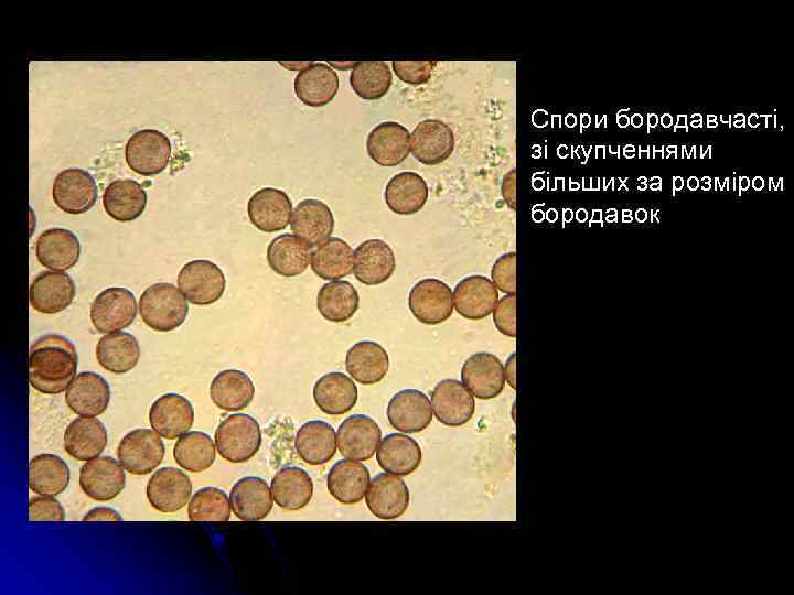 Спори бородавчасті, зі скупченнями більших за розміром бородавок 