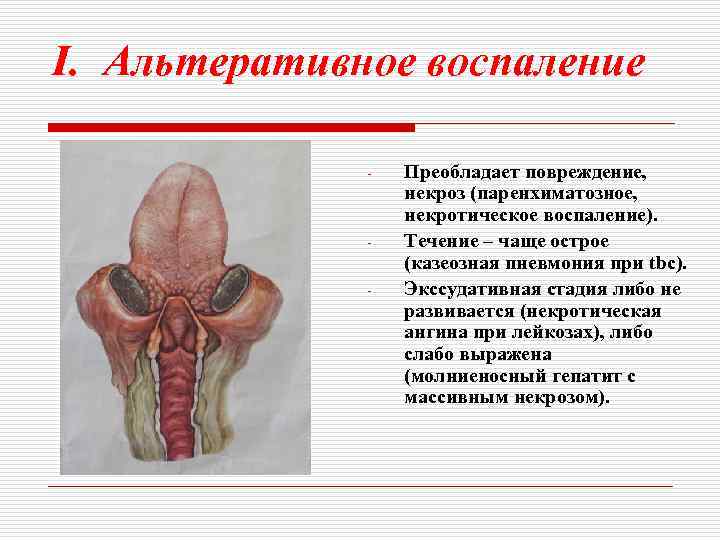 I. Альтеративное воспаление - - Преобладает повреждение, некроз (паренхиматозное, некротическое воспаление). Течение – чаще