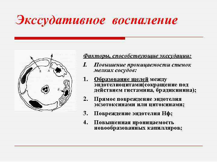 Экссудативное воспаление схема