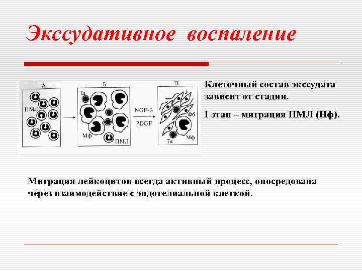 Экссудативное воспаление Клеточный состав экссудата зависит от стадии. I этап – миграция ПМЛ (Нф).