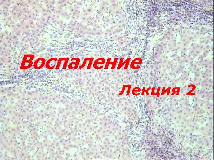 Воспаление Лекция 2 
