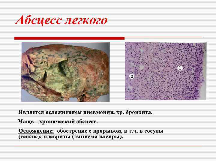 Абсцесс легкого препараты. Осложнения абсцесса легкого. Абсцесс легкого анализы. Осложнения абсцесса легкого тест с ответами. Гнойное воспаление эмпиема.