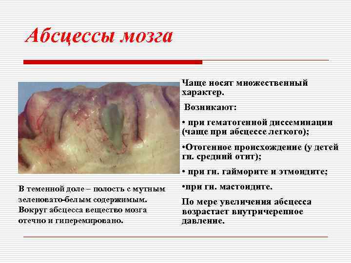 Абсцессы мозга Чаще носят множественный характер. Возникают: • при гематогенной диссеминации (чаще при абсцессе