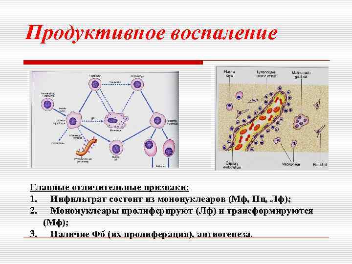Продуктивное воспаление Главные отличительные признаки: 1. Инфильтрат состоит из мононуклеаров (Мф, Пц, Лф); 2.