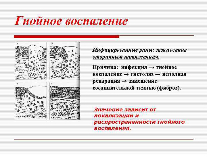 Заживление раны вторичным натяжением фото