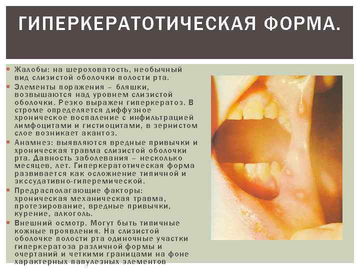 ГИПЕРКЕРАТОТИЧЕСКАЯ ФОРМА. Жалобы: на шероховатость, необычный вид слизистой оболочки полости рта. Элементы поражения –