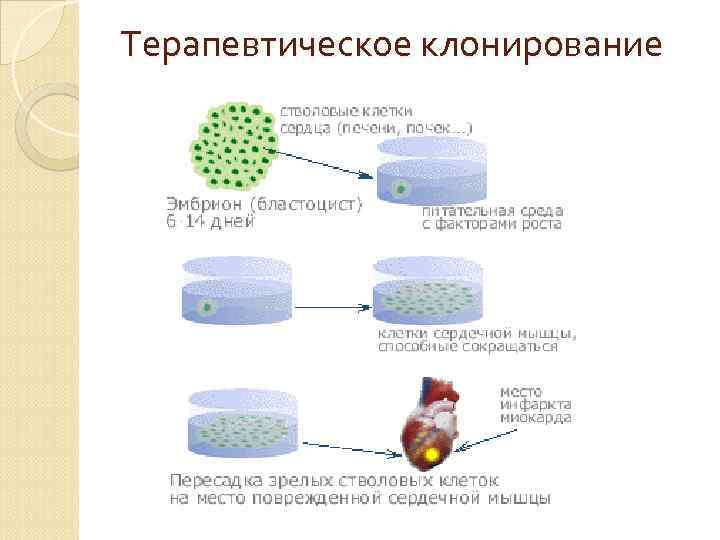 Терапевтическое клонирование 