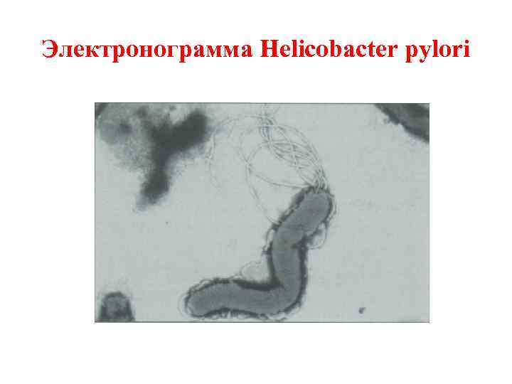 Электронограмма Helicobacter pylori 