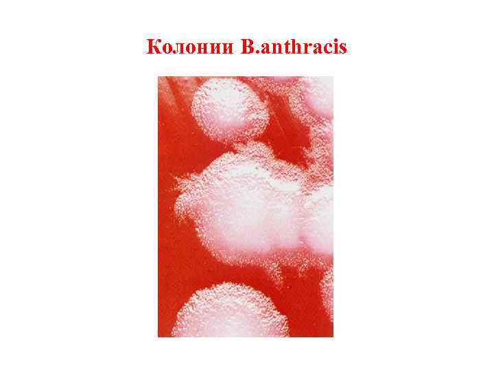 Колонии B. anthracis 