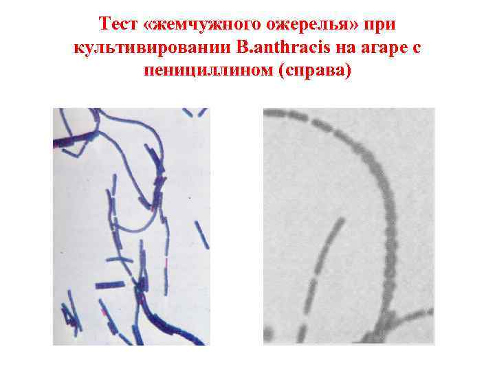 Тест «жемчужного ожерелья» при культивировании B. anthracis на агаре с пенициллином (справа) 