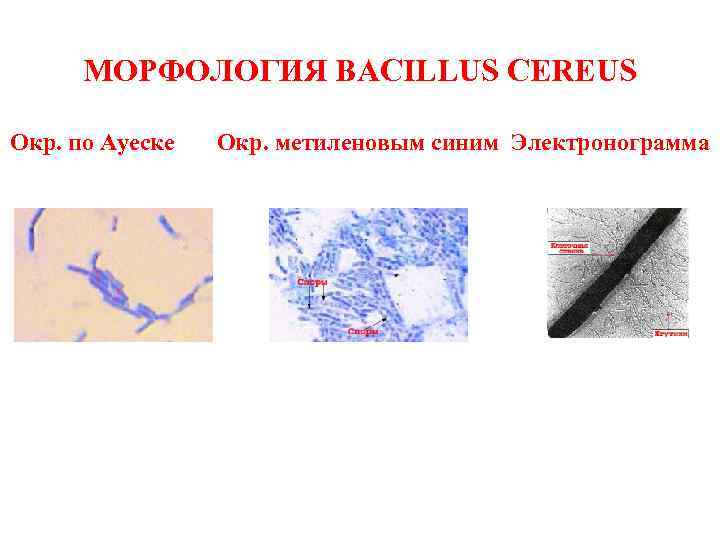 МОРФОЛОГИЯ BACILLUS CEREUS Окр. по Ауеске Окр. метиленовым синим Электронограмма 