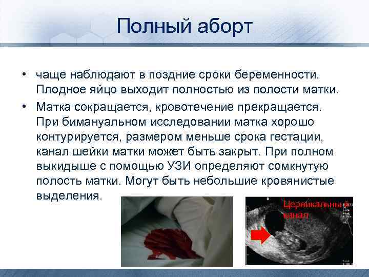Полный аборт • чаще наблюдают в поздние сроки беременности. Плодное яйцо выходит полностью из