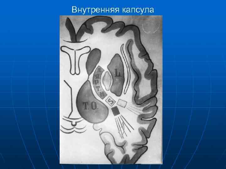 Внутренняя капсула 