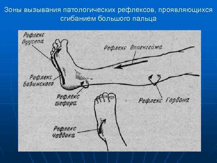 Зоны вызывания патологических рефлексов, проявляющихся сгибанием большого пальца 