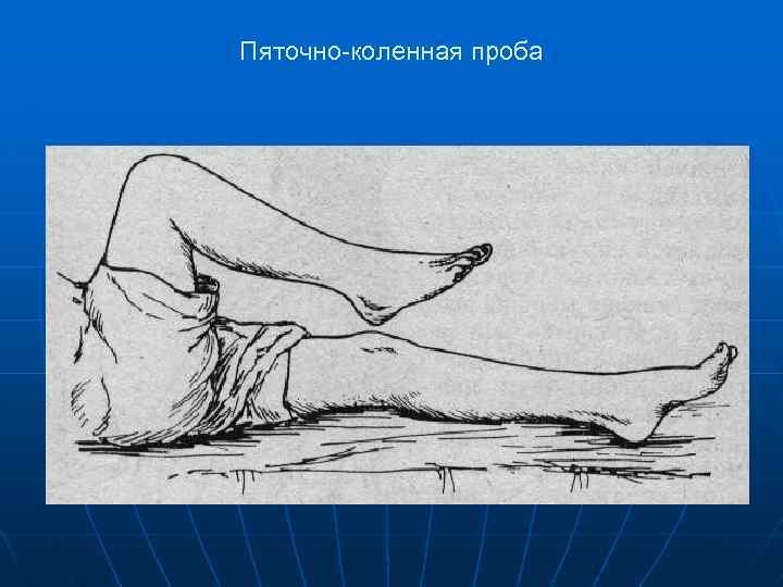Пяточно-коленная проба 