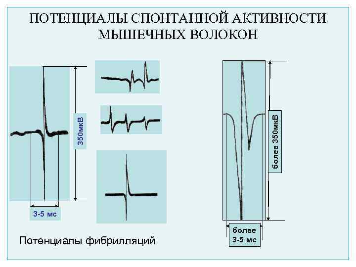 350 мк. В более 350 мк. В ПОТЕНЦИАЛЫ СПОНТАННОЙ АКТИВНОСТИ МЫШЕЧНЫХ ВОЛОКОН 3 -5