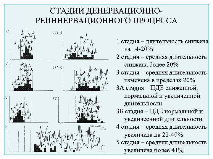 СТАДИИ ДЕНЕРВАЦИОННОРЕИННЕРВАЦИОННОГО ПРОЦЕССА 1 стадия – длительность снижена на 14 -20% 2 стадия –