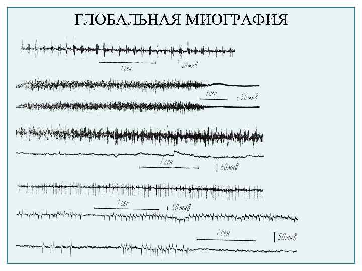 ГЛОБАЛЬНАЯ МИОГРАФИЯ 